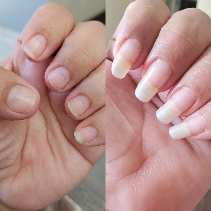 Radiant Cosmetics Organic Nail Growth Oil for Growth, Strengthening, Brightening and Moisturizing - Nail Vitamin Essentials (Vegan & Cruelty-Free)