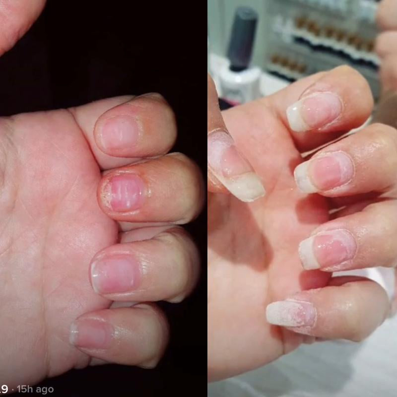 Radiant Cosmetics Organic Nail Growth Oil for Growth, Strengthening, Brightening and Moisturizing - Nail Vitamin Essentials (Vegan & Cruelty-Free)