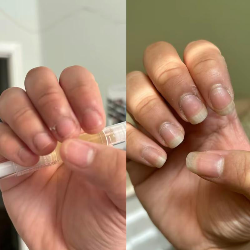 Radiant Cosmetics Organic Nail Growth Oil for Growth, Strengthening, Brightening and Moisturizing - Nail Vitamin Essentials (Vegan & Cruelty-Free)